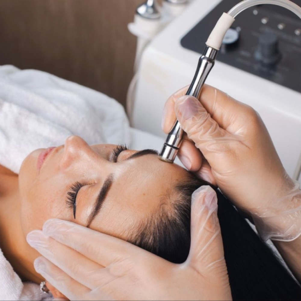 Microdermabrasion Facial