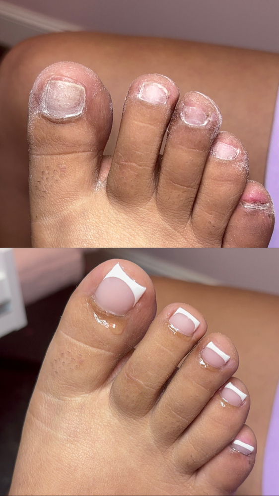 French Acrylic Full Set (Toes)