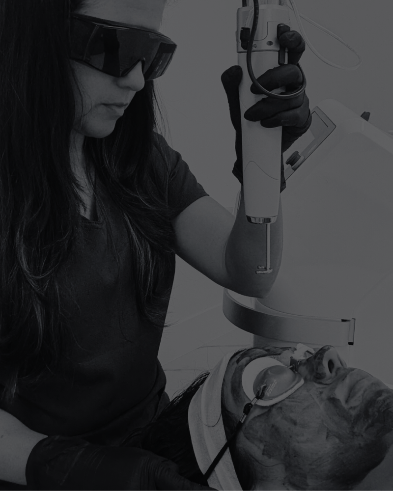 đź’Ž Carbon Laser+Dermaplaning