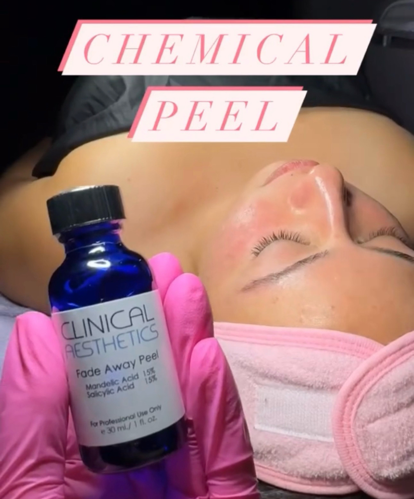 Chemical Peel at ANG BEAUTÉ in Houston, TX