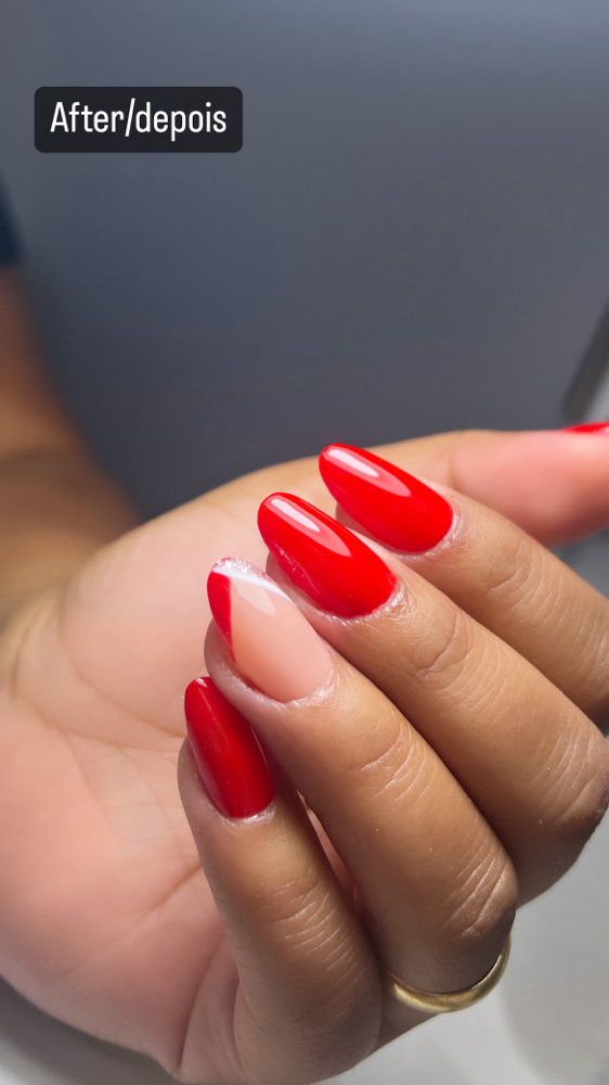 Gel X