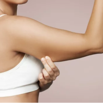 Arm Cavitation & RF Treatment at Skin Retribution in Roseville, CA