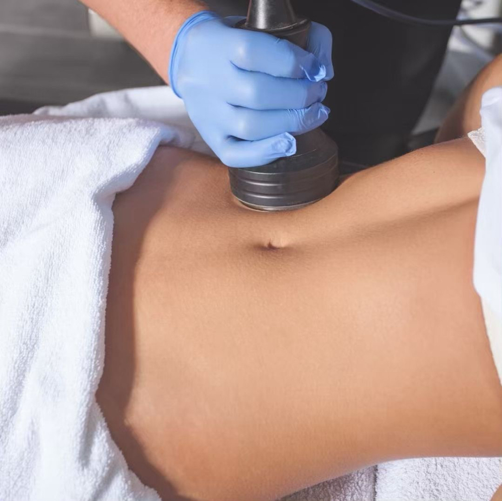 Body Cavitation at The Vanity Club in Atlanta, GA