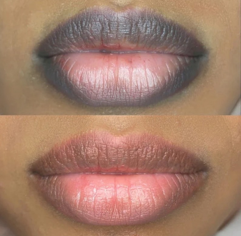 Dark Lips Correction (special)