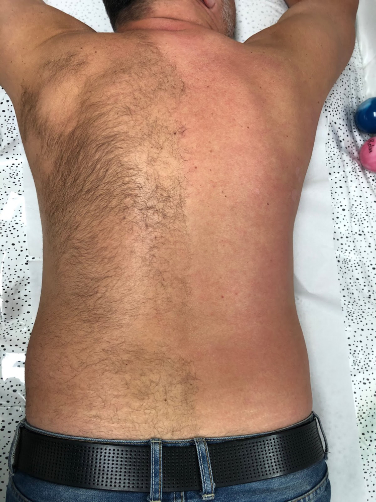 Mens Back Wax