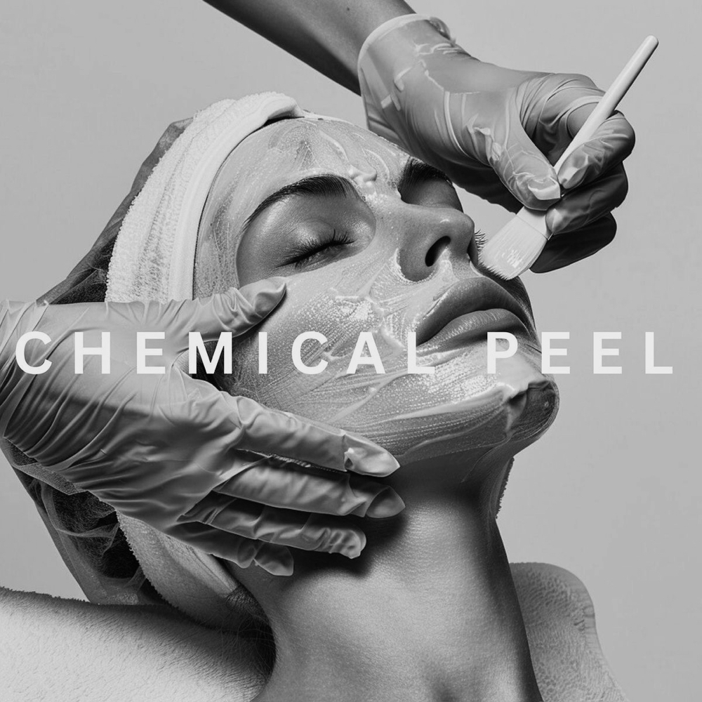 Back Chemical Peel