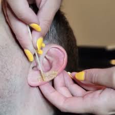 Ear Wax