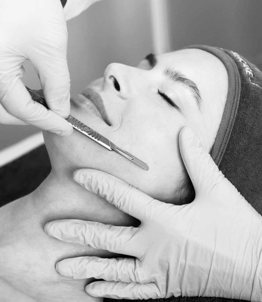 Dermaplaning Add On