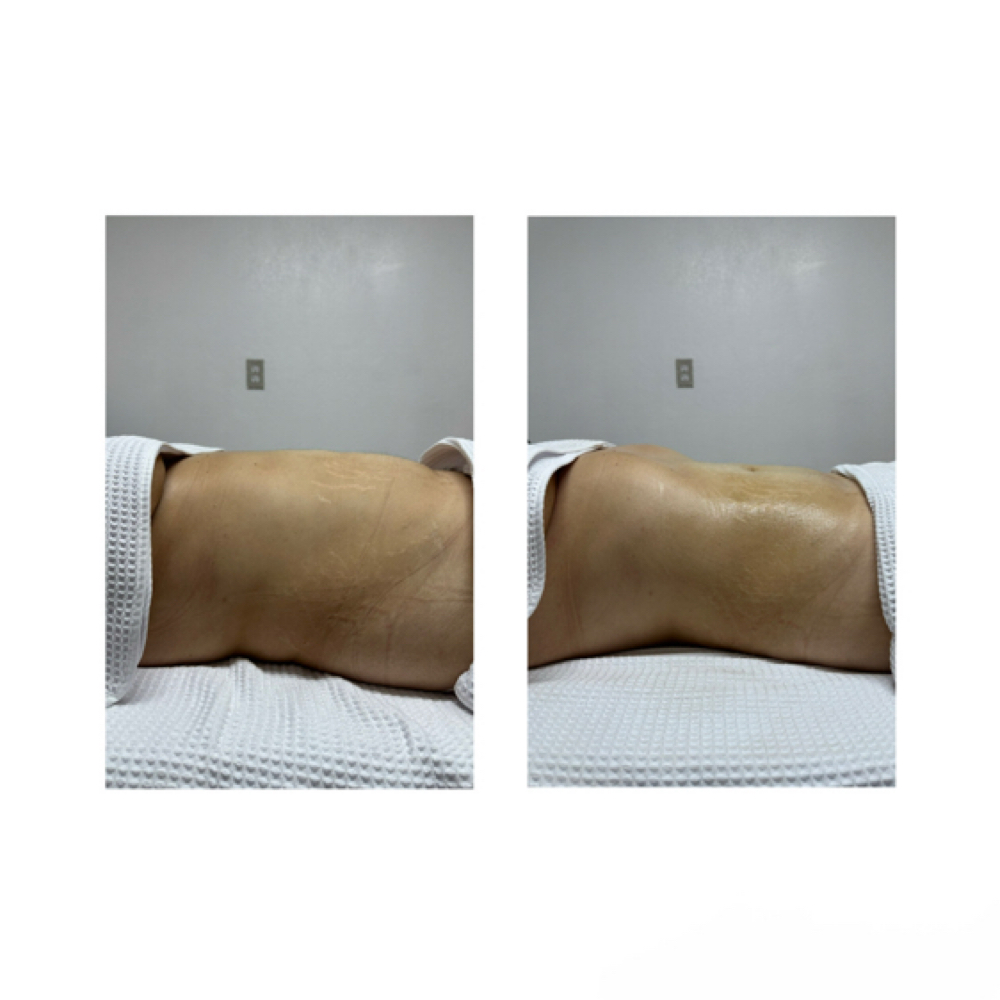 Health & Wellness MLD at Luxe Beauty Studio in Cottonwood, AZ