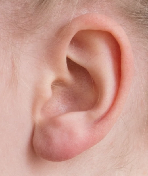 Ear Wax