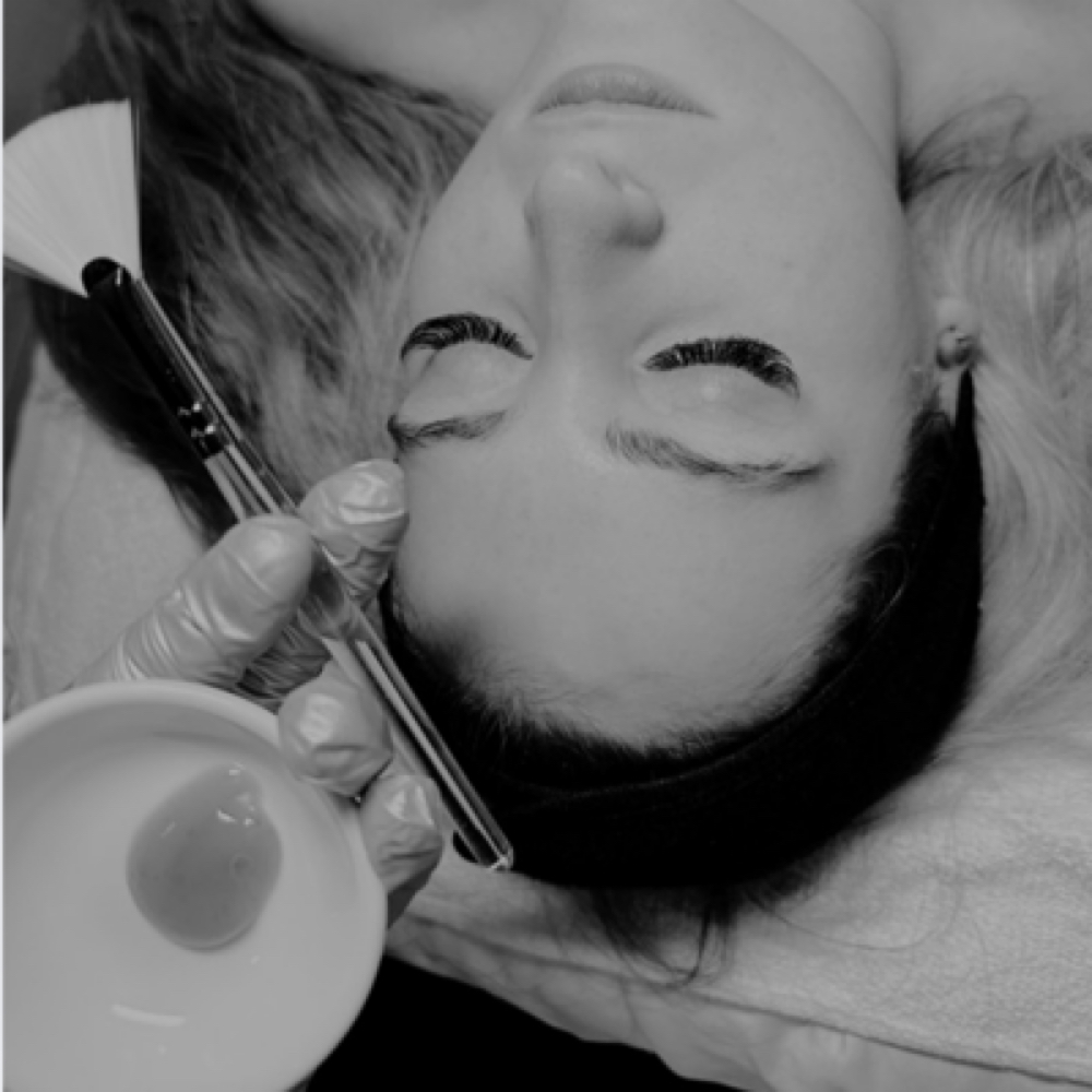 Enzyme Treatments at Bare Aesthetics By Chloe in Lake Norman of Catawba, NC