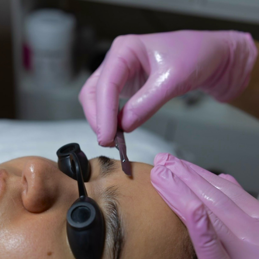 Facial Add On: Dermablade at Aura Bella in Collierville, TN