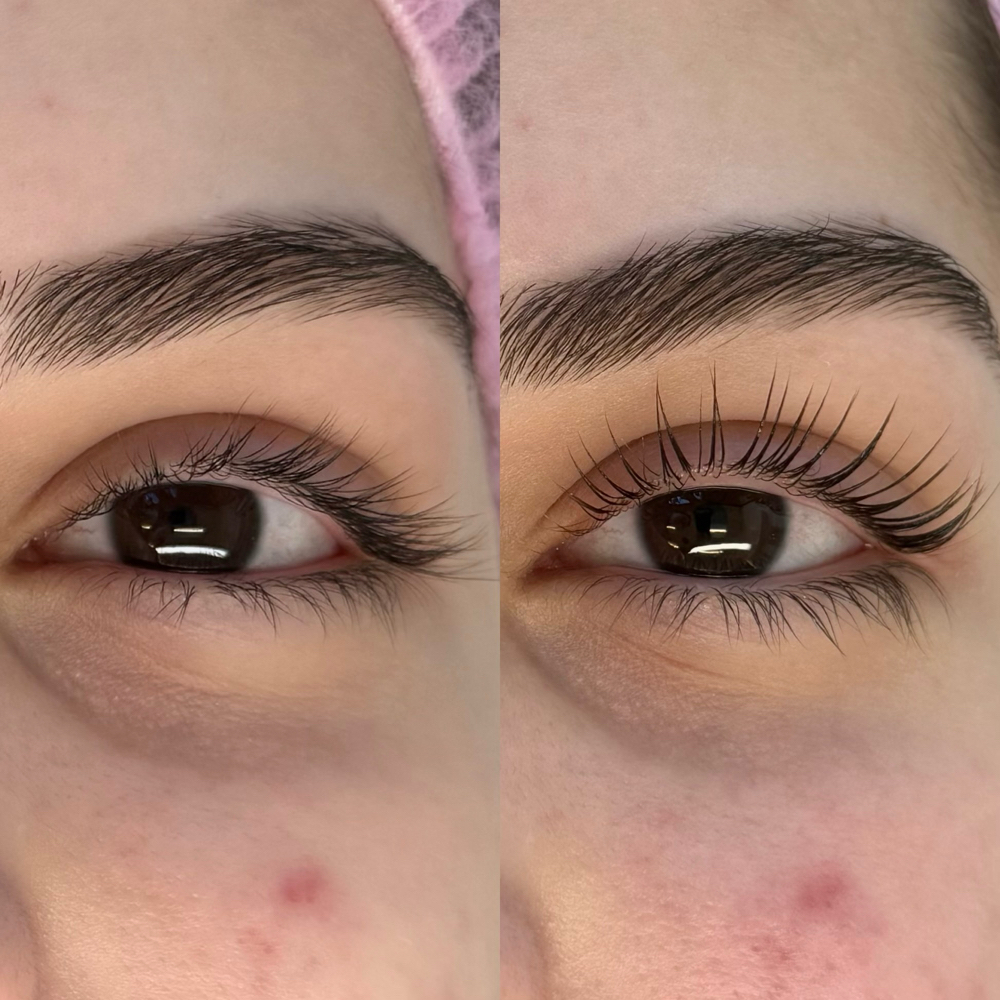 Lash Lift