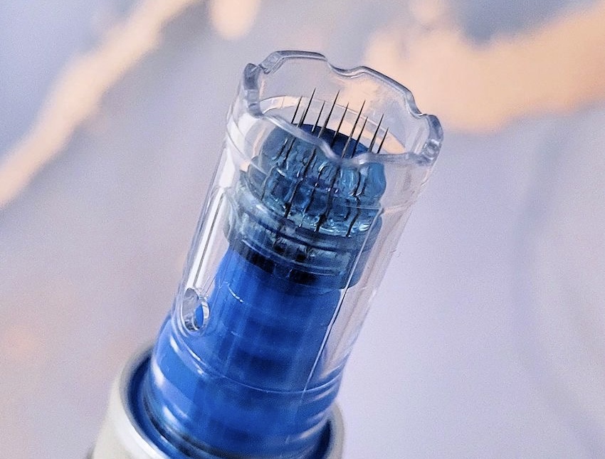 Microneedling 6 sessions