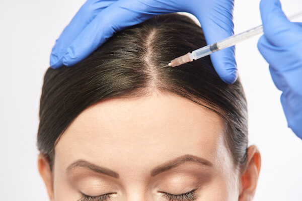 PRP Hair restoration at Alabaster Beauty Co in Scottsdale, AZ