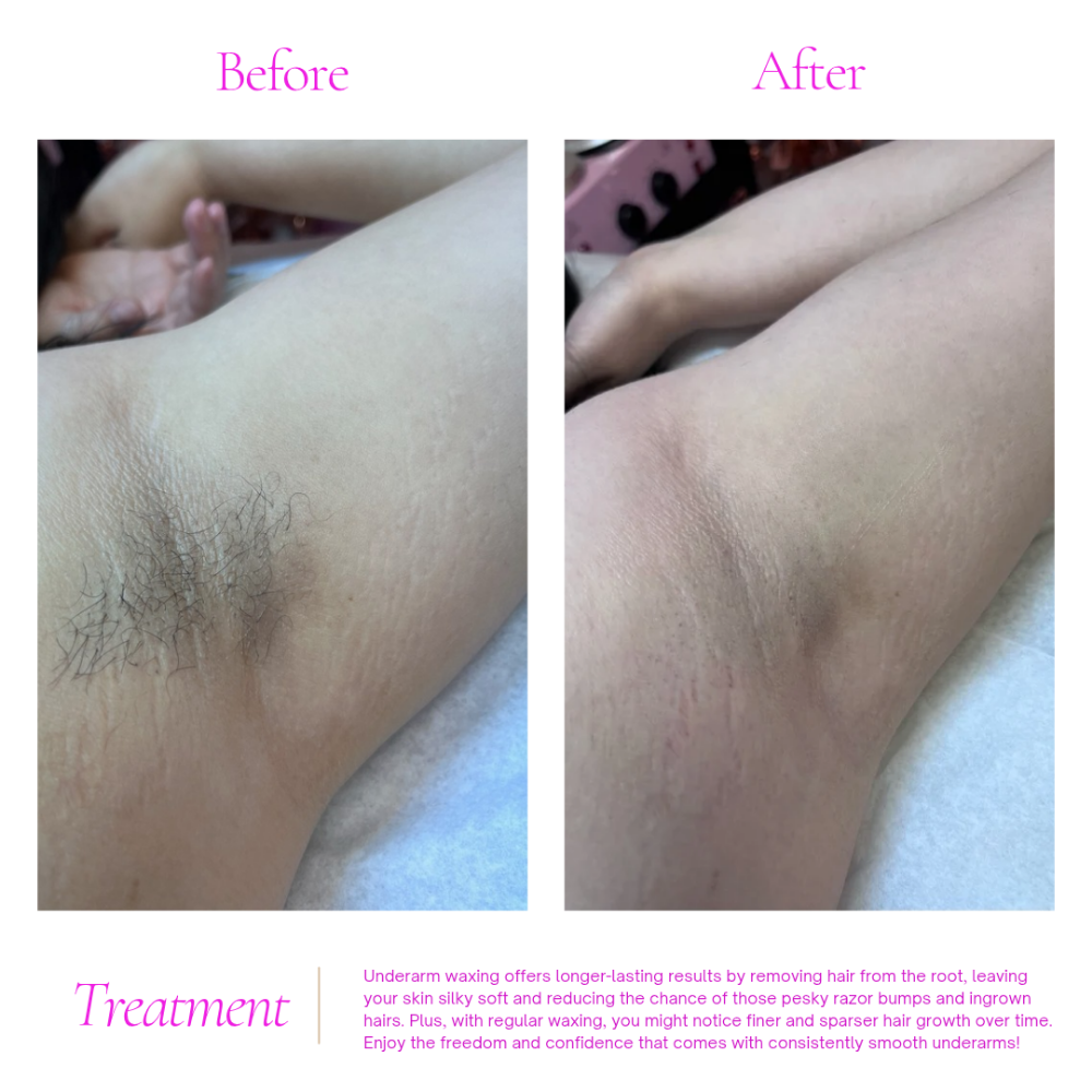 Underarm Wax