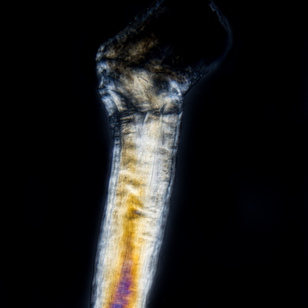 Follicle Analysis Polarized Light at Space Cat Hair Company in Palm Beach Gardens, FL