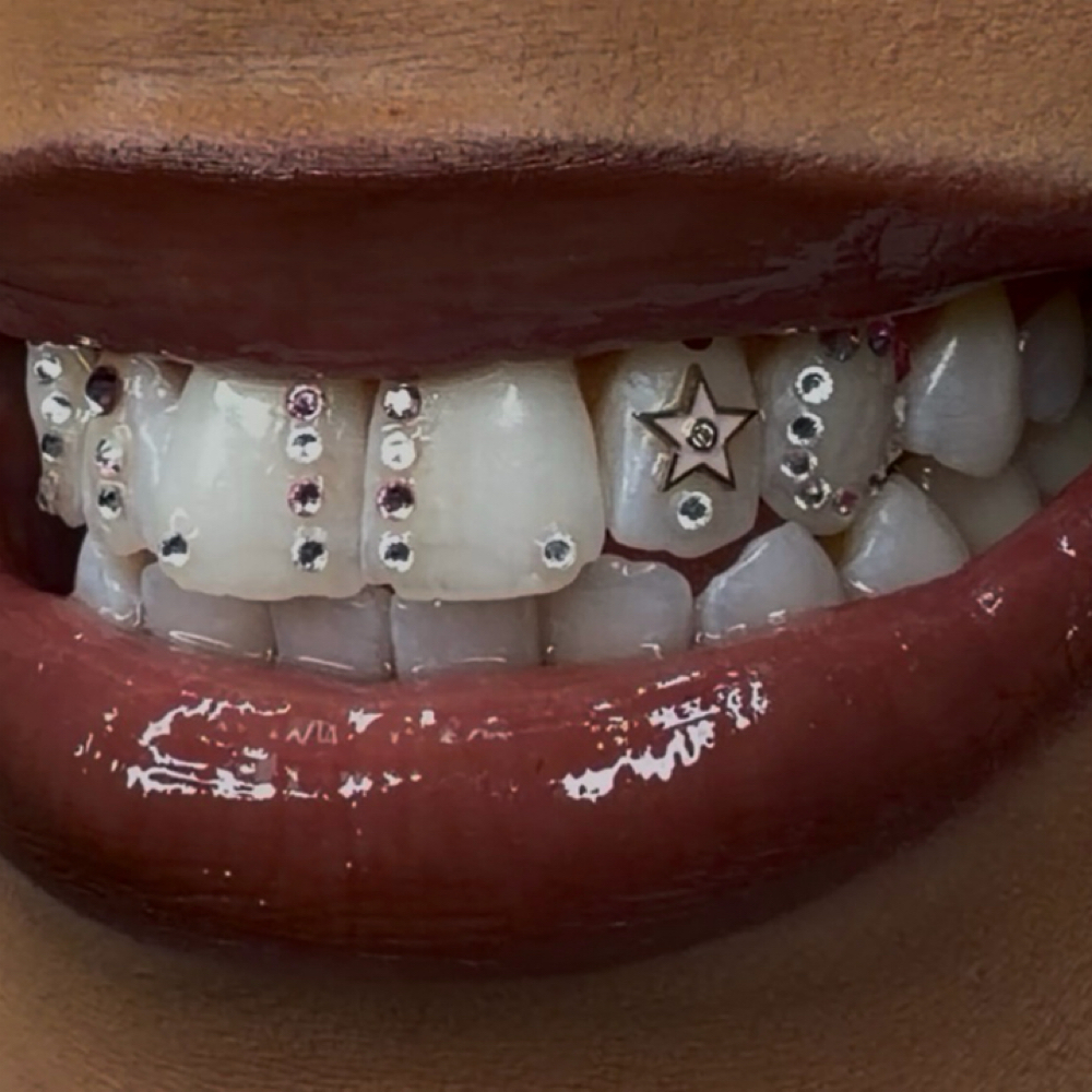 18kt Gold toothgem at PsychoTeeth in manhattan, NY