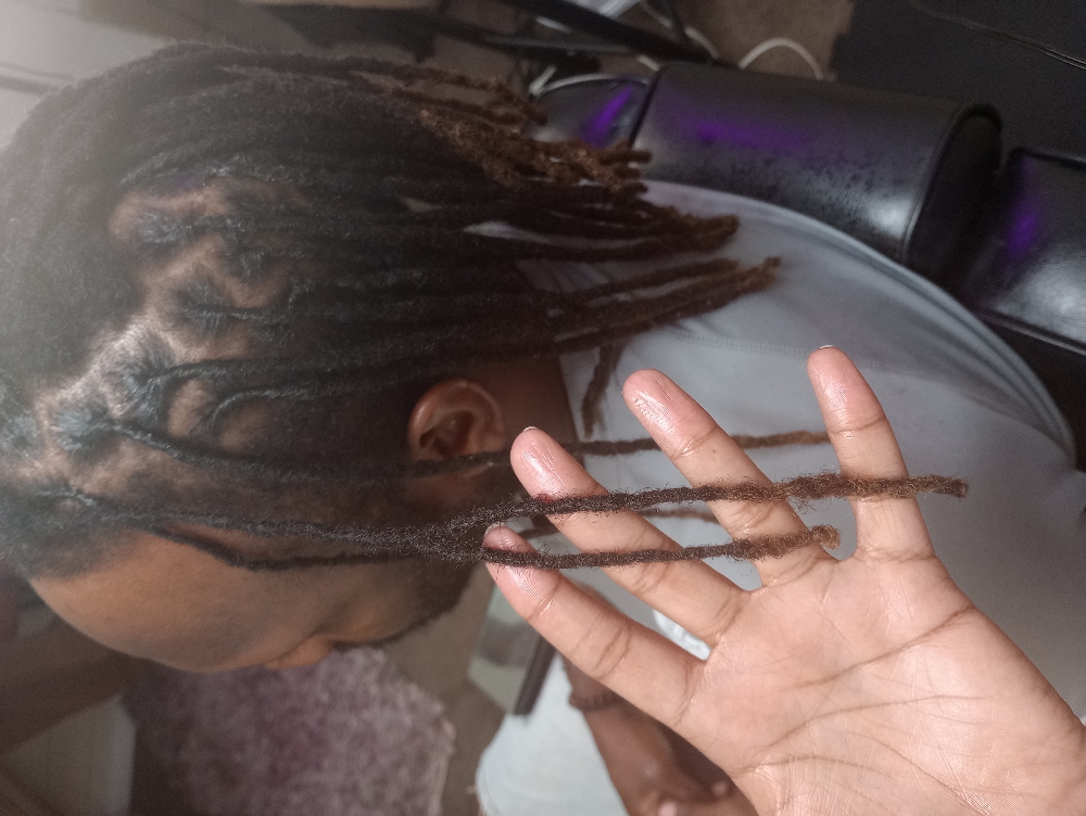 Repair Or Re-attachment & Retwist