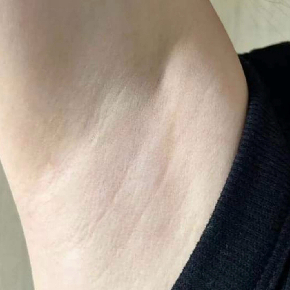 Underarm at Charity Denise Beauty Studio in Towson, MD