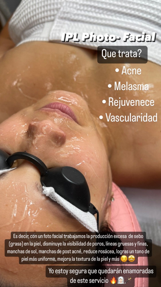 IPL photo-Facial