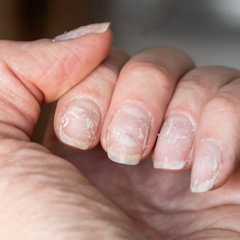 Nail Repair Treatment at Purely Polished in Amarillo, TX