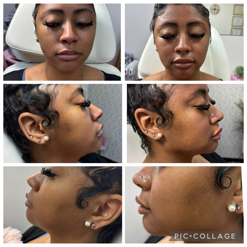 Facial Balancing