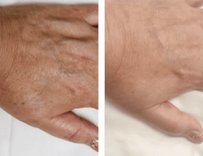 BioRepeel Gold Hand Treatment