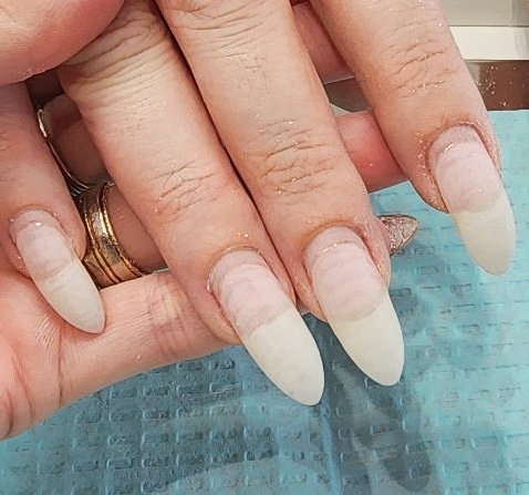 Removal Add-On