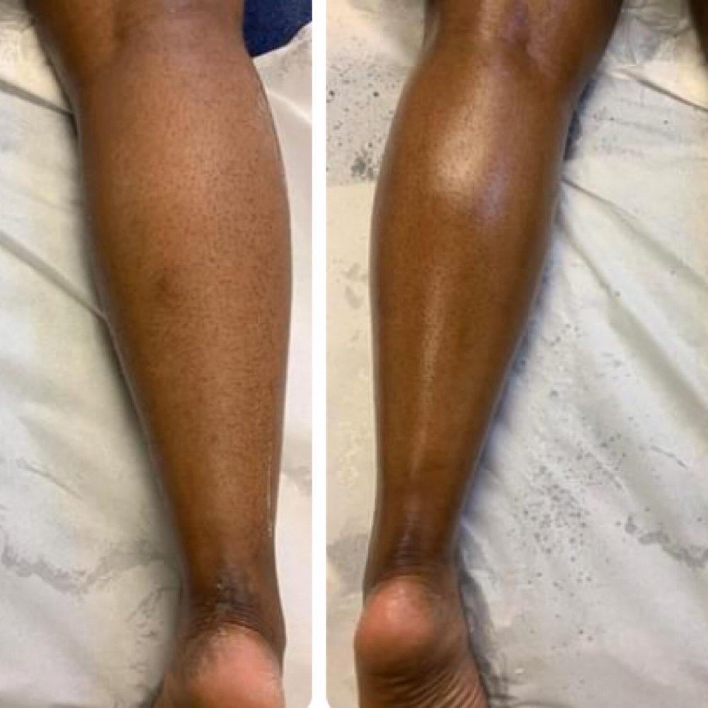 Leg Waxing at Poshii GOAT Esthetics in Carmel, IN