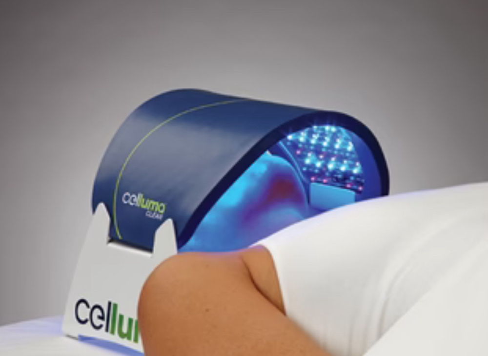 LED Blue Light Therapy