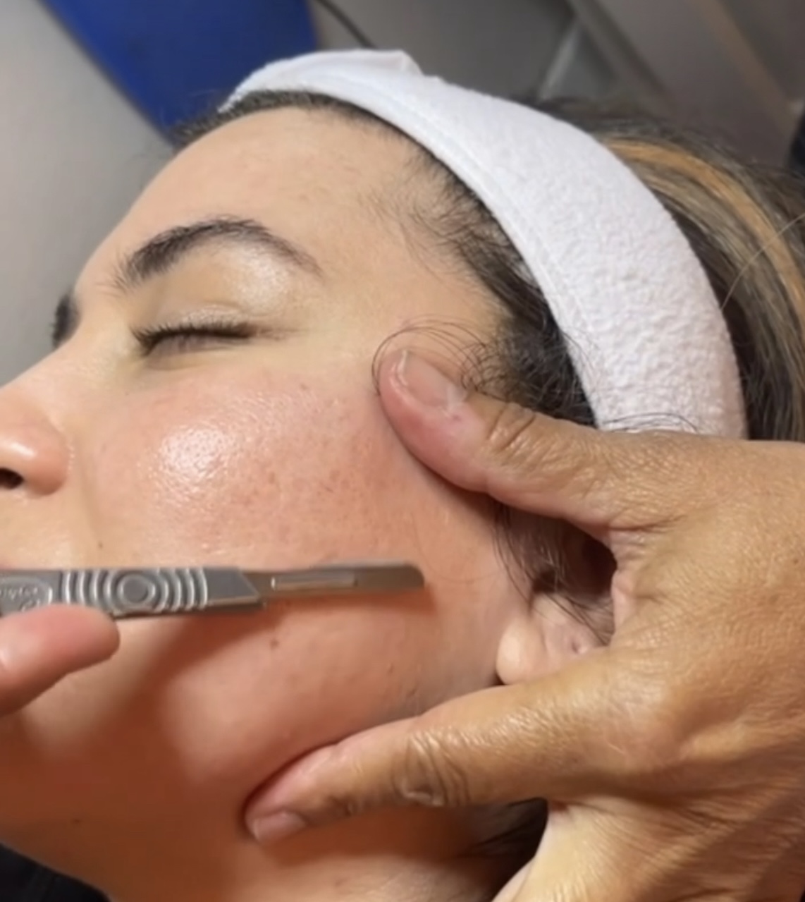 Dermaplane Facial