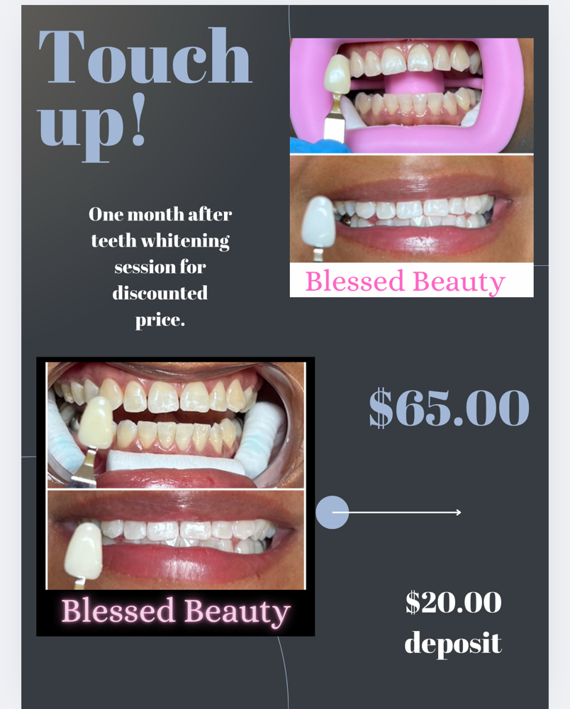 Teeth Whitening/Touch Ups! at Blessed Beauty in El Paso, TX