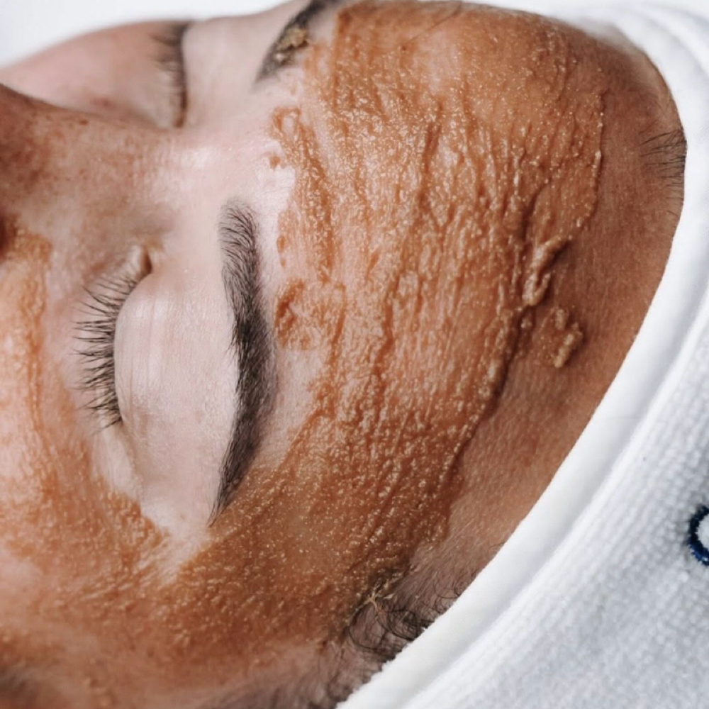 Acne Facial at Pretty Beautiful Aesthetics in Trinity, FL