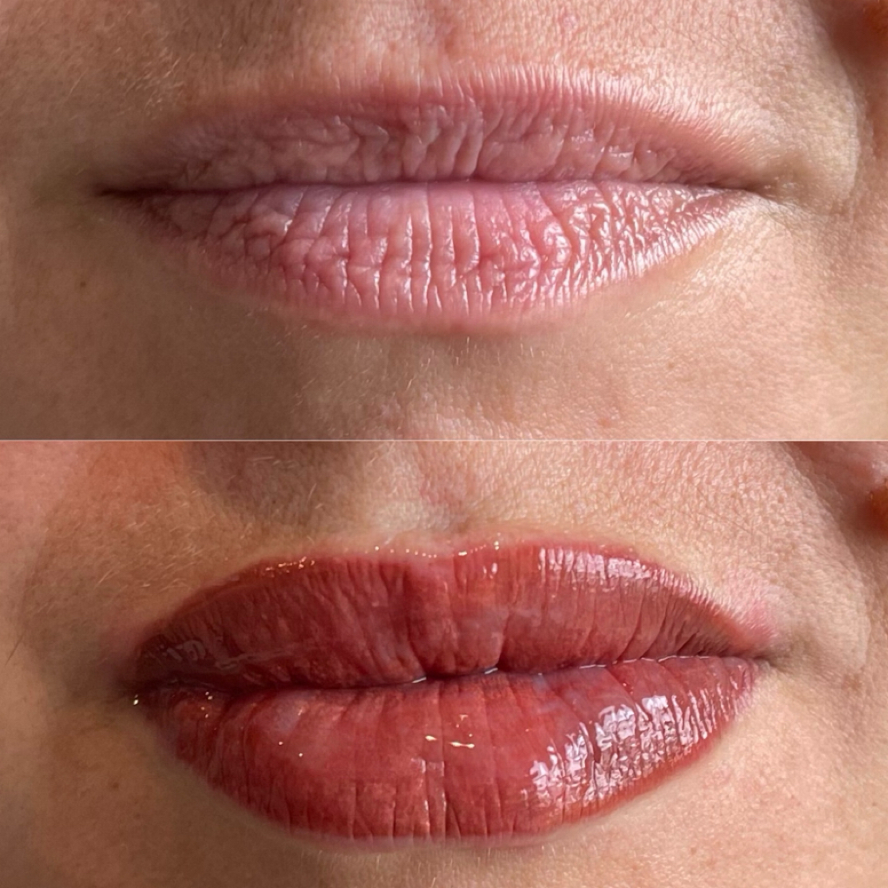 Lip Blushing Initial at Innovative Medical Aesthetics in Slidell, LA