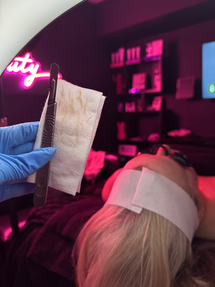 Dermaplane Treatment