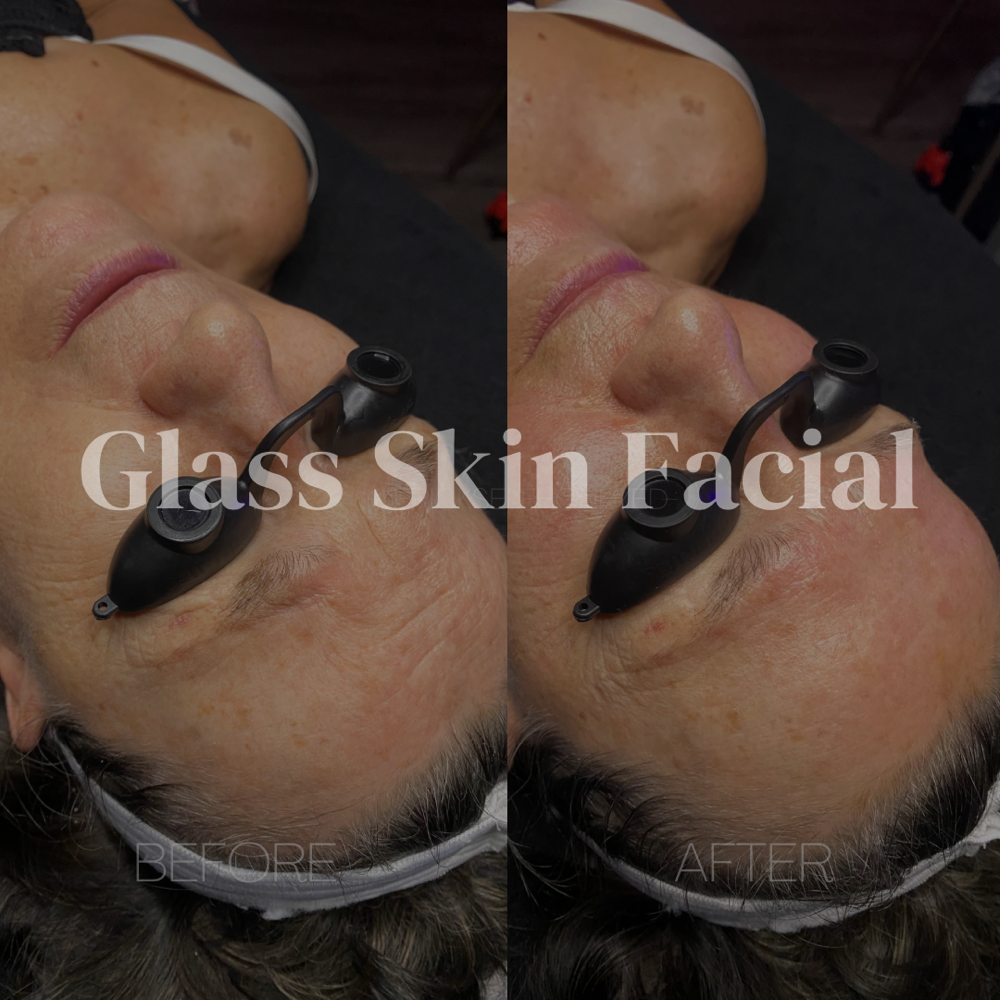 Glass Skin Facial