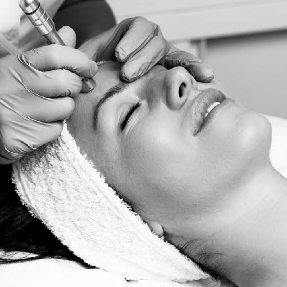 Microdermabrasion at Anointed Aesthetics LLC in Shelton, CT