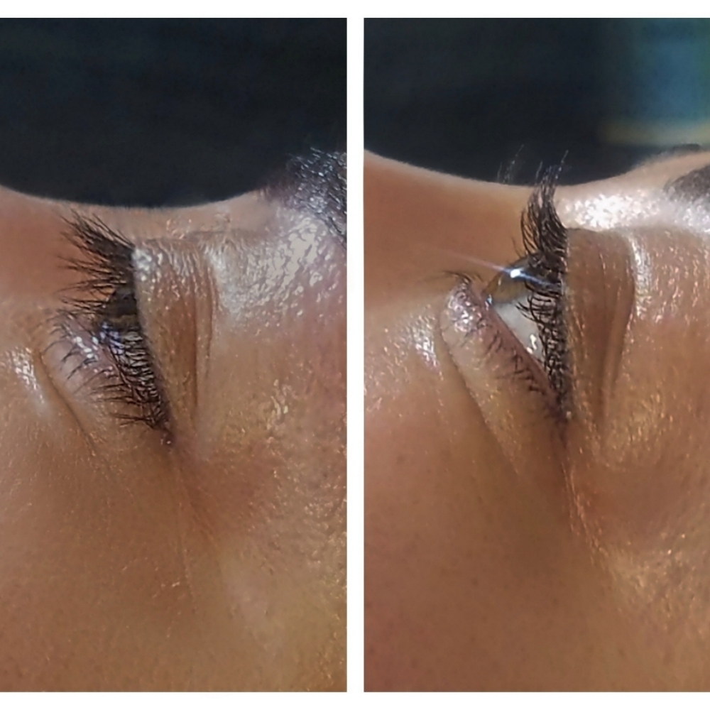 Lash Lift at Phoenix Esthetics in Salem, OR