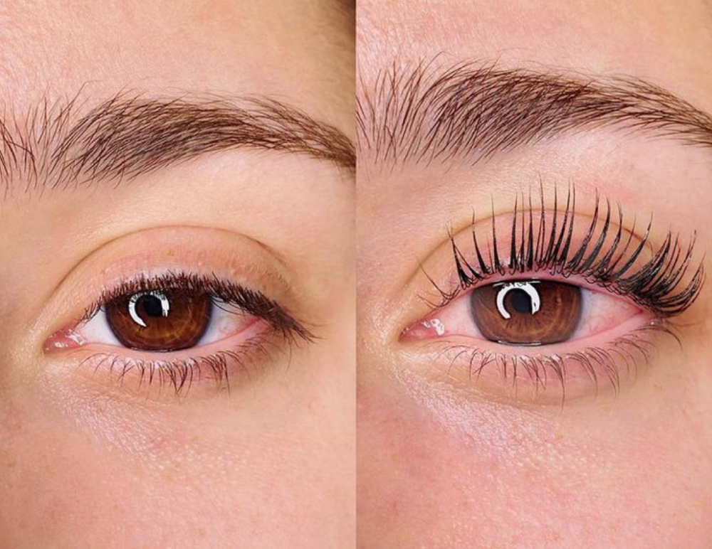 Eyelash Lift