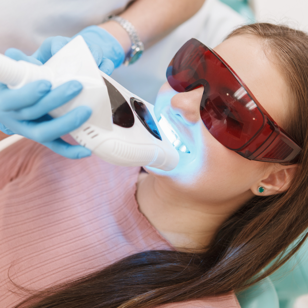 Professional Teeth Whitening
