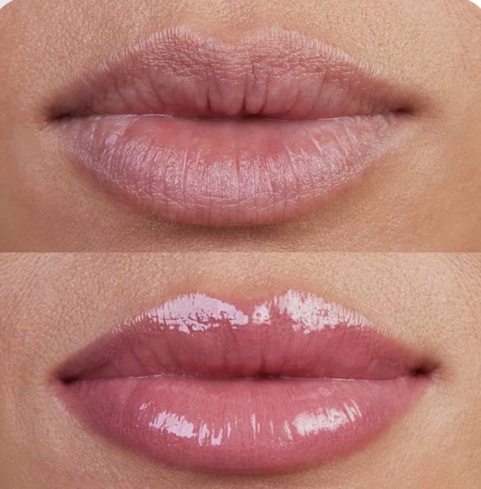 Crystal Lips