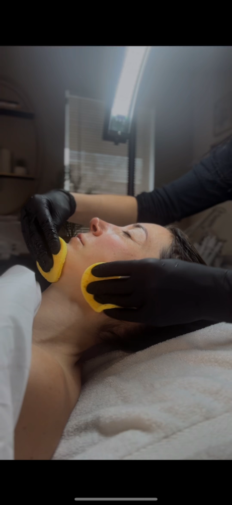 Peel Add-on