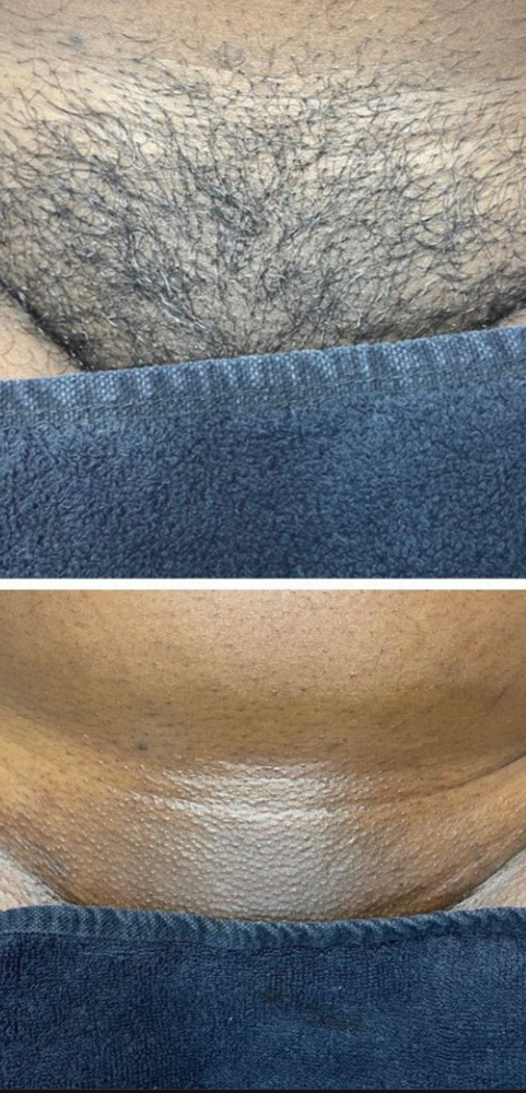 Signature Bikini Wax at Azura Natural Wellness in Highland, IN