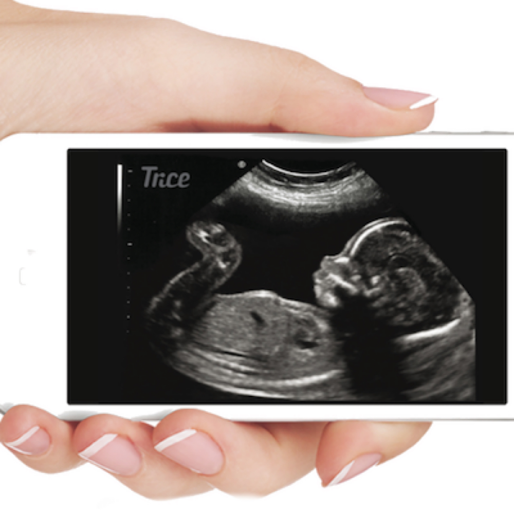 Instant Online Ultrasound Gallery