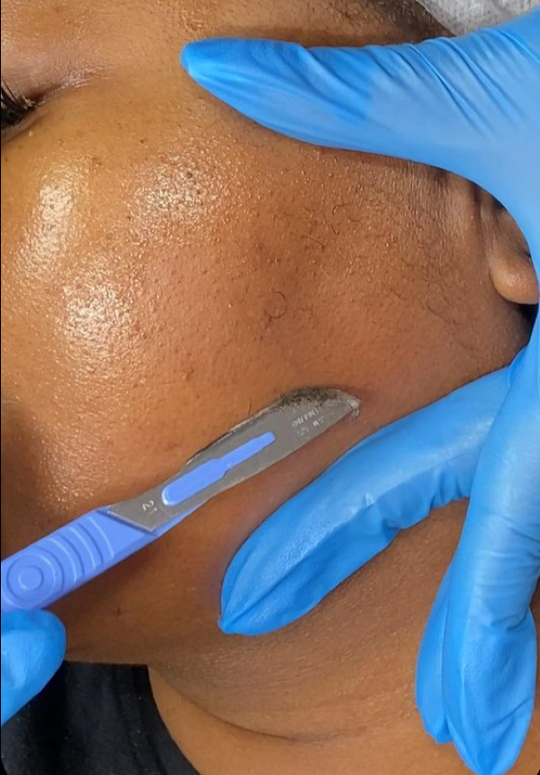 Glow Facial (Enzyme+Dermaplaning) at Brandy The Esthetician in Shreveport, LA