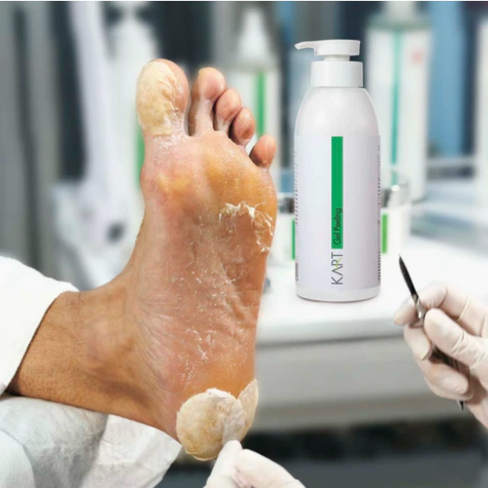 KART PEDICURE at Teas Podocenter in Ardmore, PA