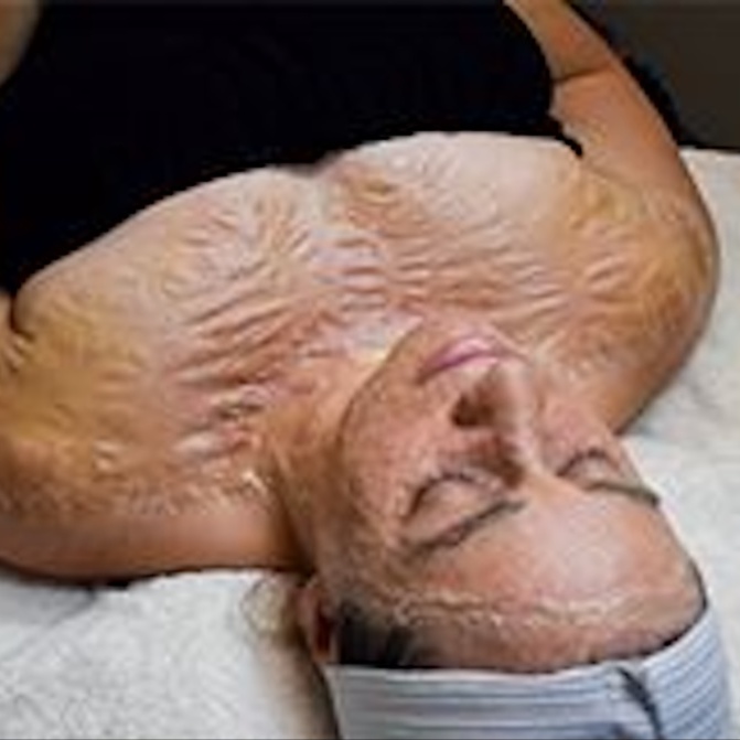 Protein Lift Firming Facial at LB Glow Esthetics in Pacific Grove, CA