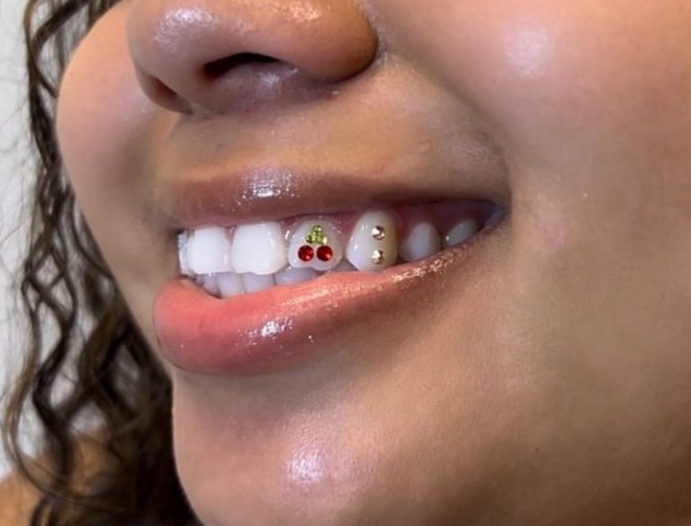Cherry Design Tooth Gems