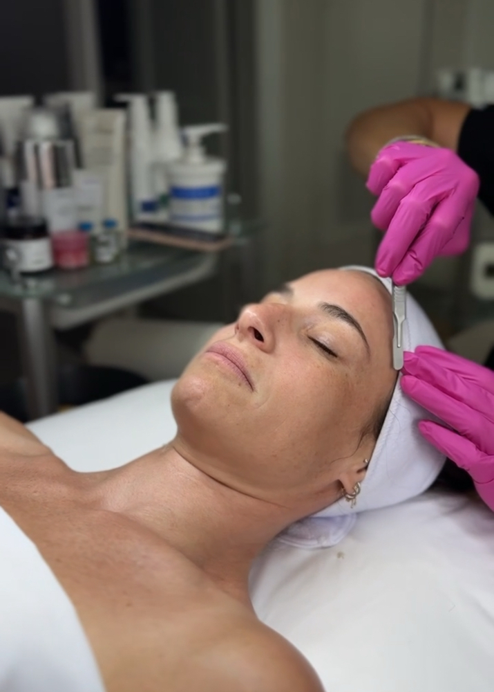 Dermaplane Treatment
